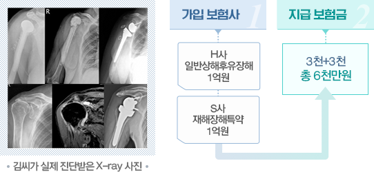 참벗손해사정