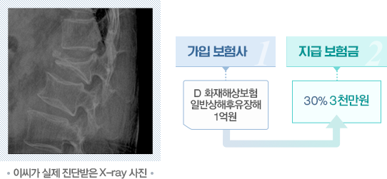 참벗손해사정